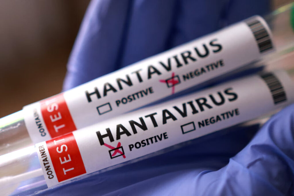 hanta-virus-23-desho-tak-kaise-pahucha-sankraman