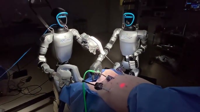 Pehli-baar-2-Robots-ne-gallblader-surgery-ki
